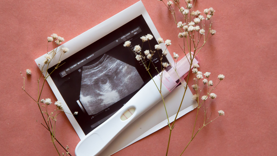 Ecografía de embarazo - mitos y realidades Babybelegal